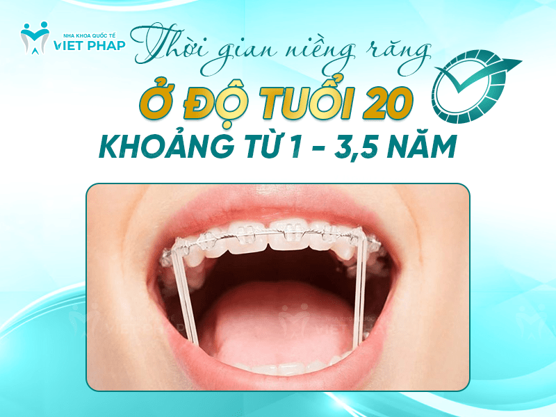20 tuoi nieng rang bao lau 1 Thời gian niềng răng ở độ tuổi 20 khoảng từ 1 - 3,5 năm