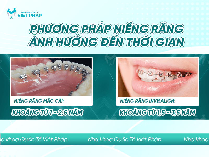 20 tuoi nieng rang bao lau 2 Phương pháp niềng răng ảnh hưởng đến thời gian