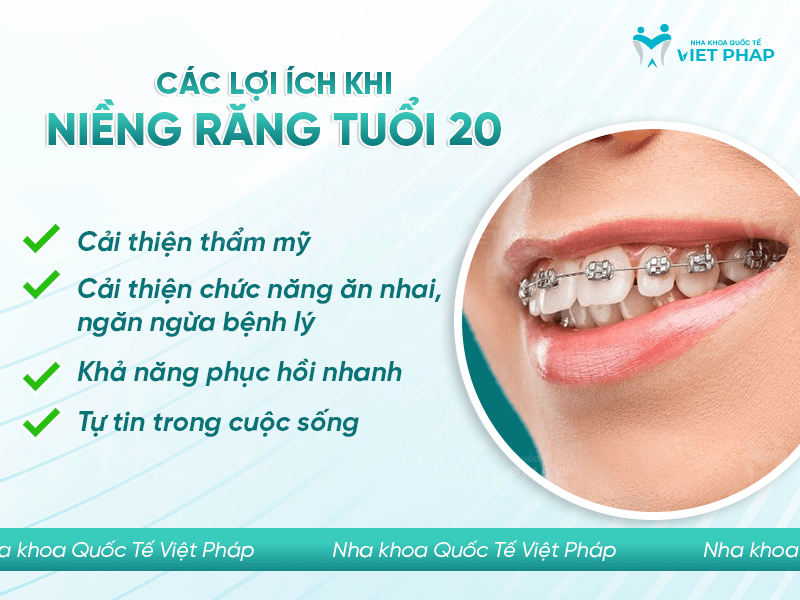 20 tuoi nieng rang bao lau 6 Các lợi ích khi niềng răng tuổi 20