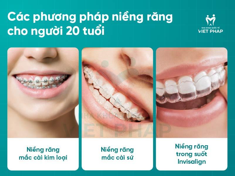 Các phương pháp niềng răng cho người 20 tuổi 
