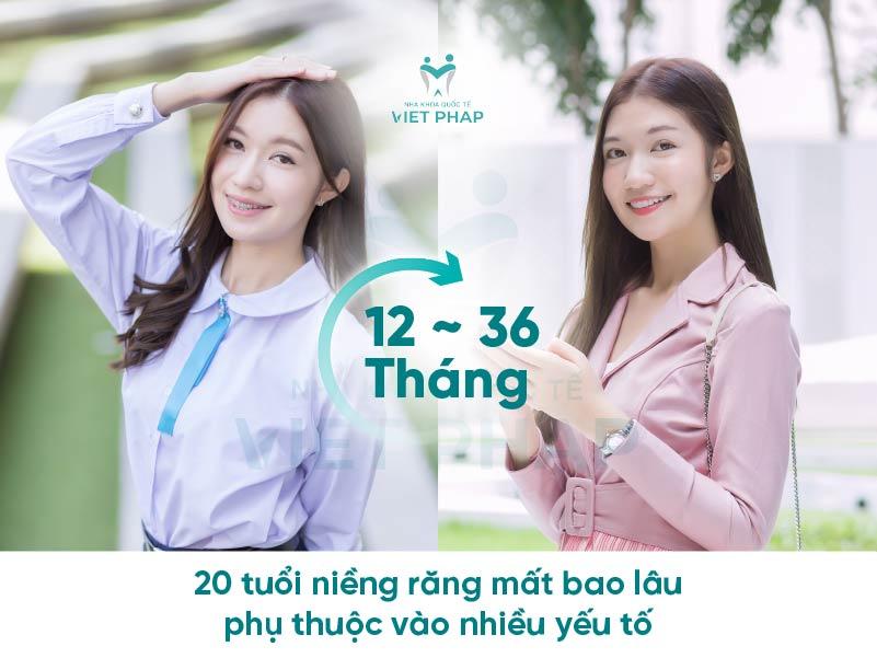 20 tuổi niềng răng mất bao lâu phụ thuộc vào nhiều yếu tố