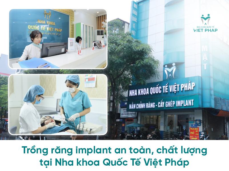 Nha khoa Quốc Tế Việt Pháp - địa chỉ trồng răng implant an toàn, chất lượng