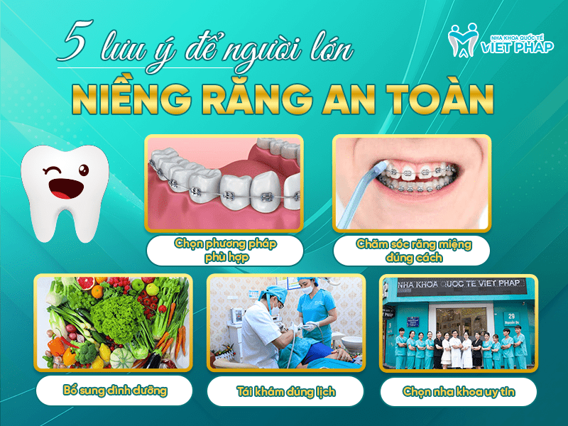 5 lưu ý để người lớn niềng răng an toàn