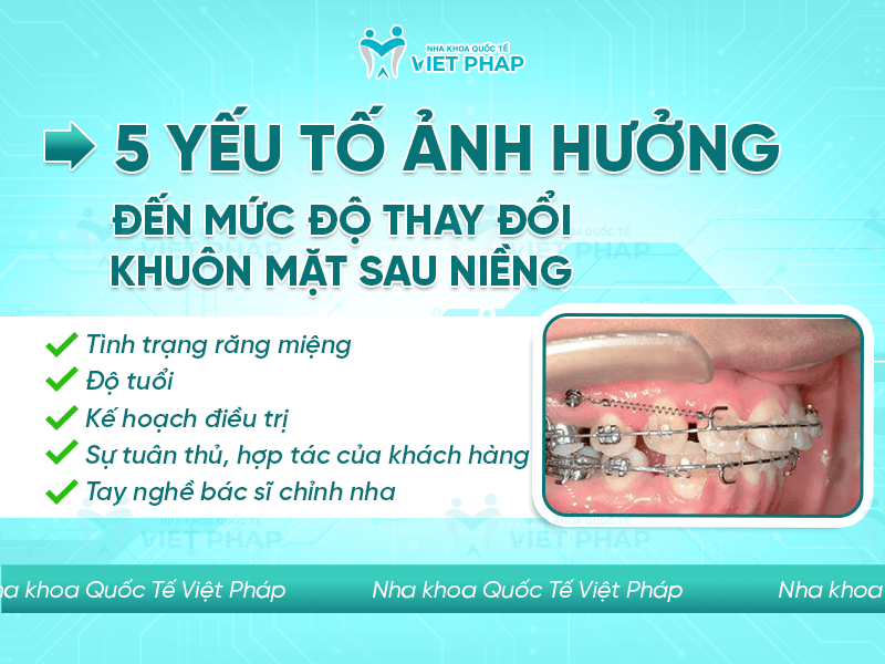 5 yếu tố ảnh hưởng đến mức độ thay đổi khuôn mặt sau niềng răng