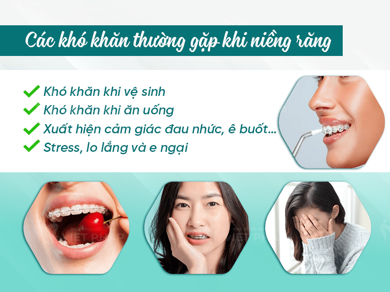 Review nieng rang 1 Các khó khăn thường gặp khi niềng răng