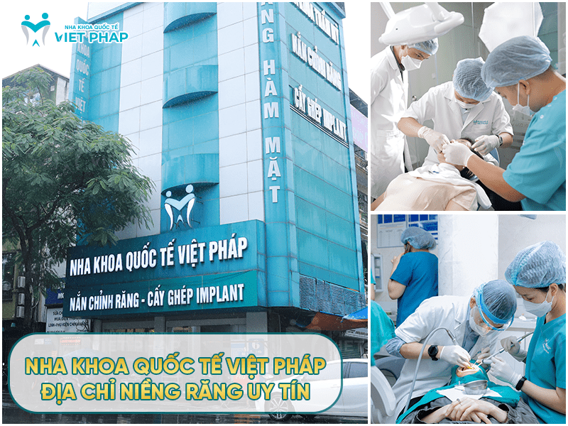 Review nieng rang 3 Nha khoa Quốc Tế Việt Pháp - địa chỉ niềng răng uy tín