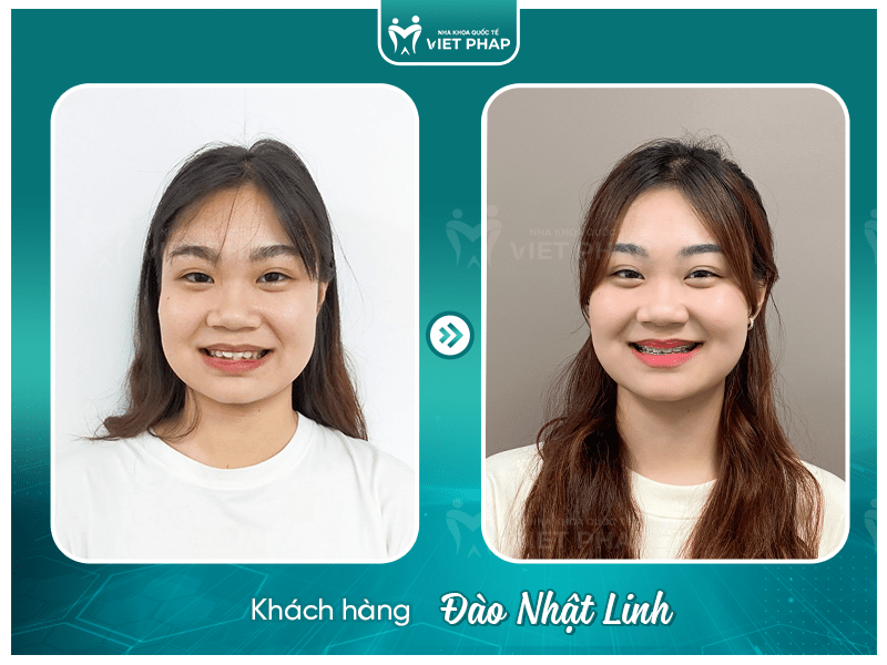 Review nieng rang Dao Nhat Linh Khách hàng Đào Nhật Linh