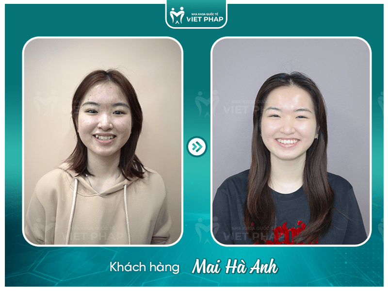 Review nieng rang Mai Ha Anh Khách hàng Mai Hà Anh
