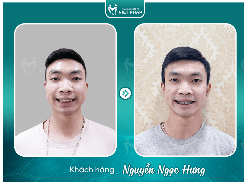 Review nieng rang Nguyen Ngoc Hung Khách hàng Nguyễn Ngọc Hưng