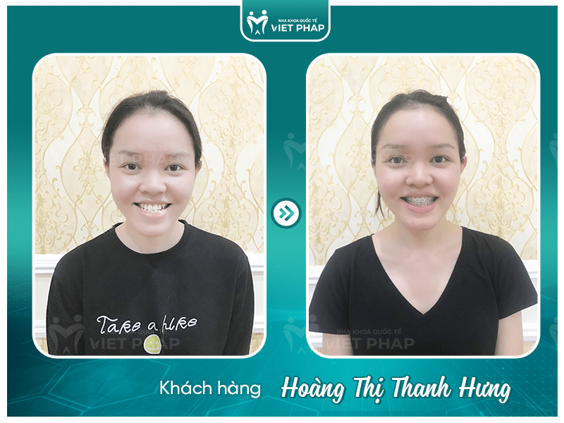 Review nieng rang Thanh Hung Khách hàng Hoàng Thị Thanh Hưng