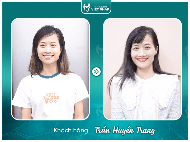 Review nieng rang Tran Huyen Trang 1 Khách hàng Trần Huyền Trang