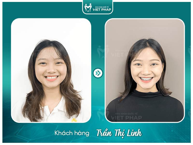 Review nieng rang Tran Thi Linh Khách hàng Trần Thị Linh