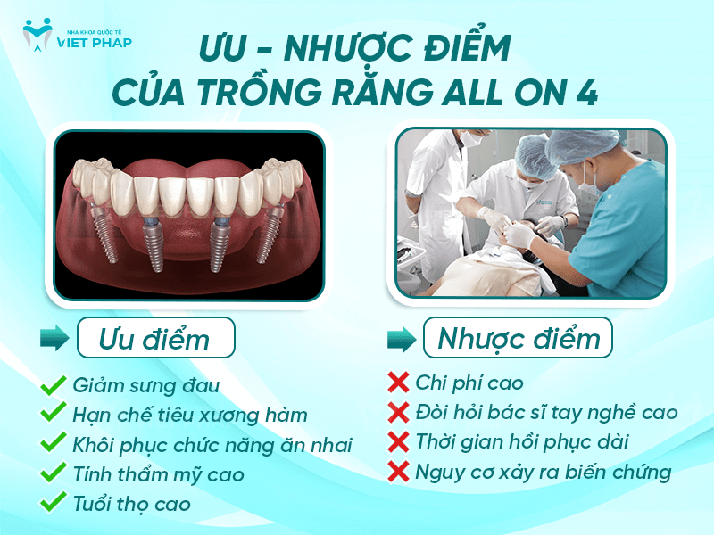 Ưu - nhược điểm của trồng răng implant All On 4