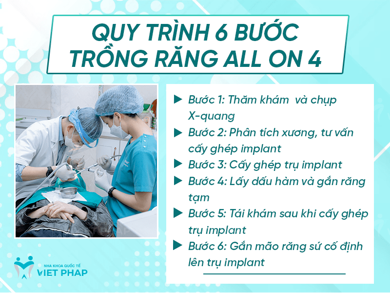 Quy trình 6 bước trồng răng All On 4