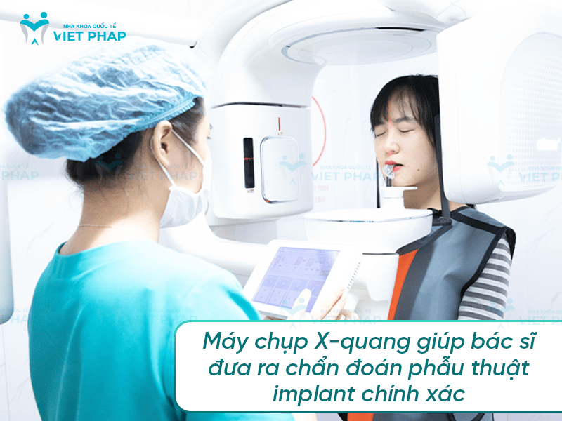 Dung cu cay ghep implant 6 Máy chụp X-quang giúp bác sĩ đưa ra chẩn đoán phẫu thuật implant chính xác