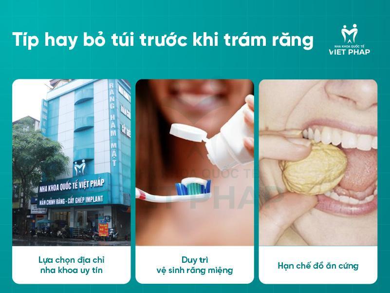 Tip hay bỏ túi trước khi trám răng