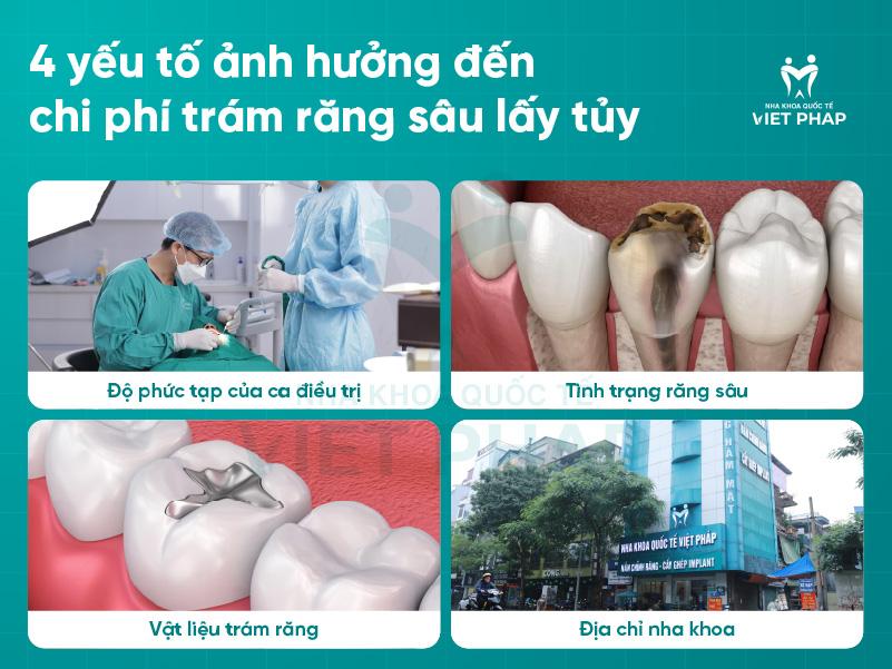 Tram rang sau lay tuy gia bao nhieu 3 4 yếu tố ảnh hưởng đến chi phí trám răng sâu lấy tủy