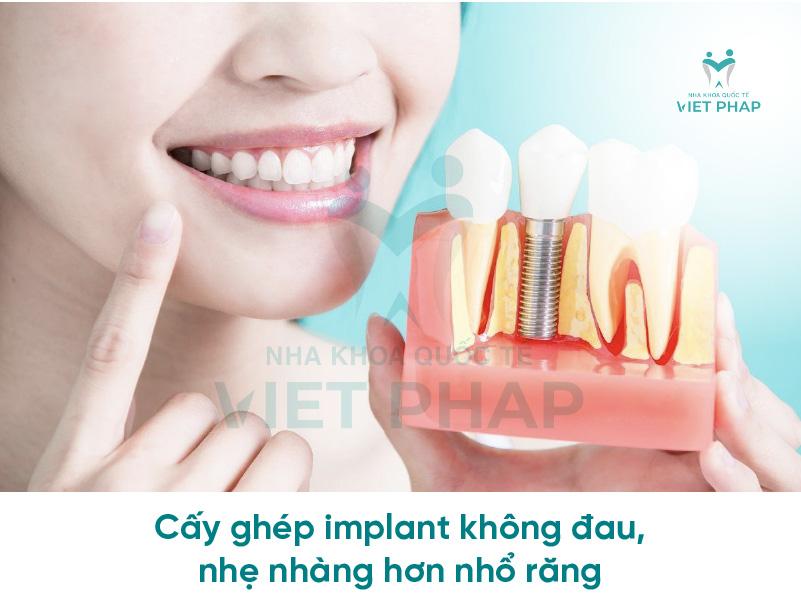 Cấy ghép implant không đau, nhẹ nhàng hơn nhổ răng