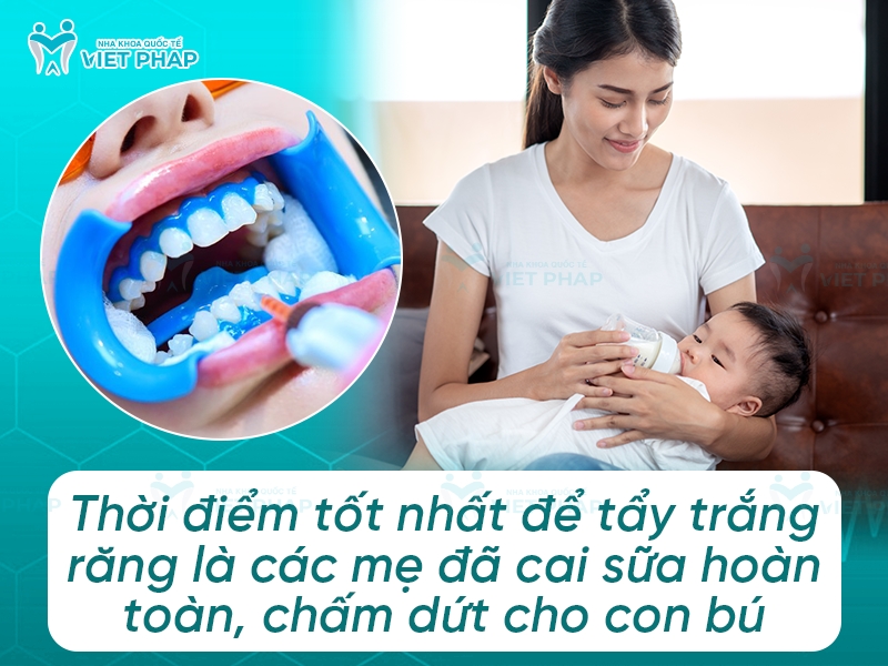 Thời điểm tốt nhất để tẩy trắng răng là các mẹ đã cai sữa hoàn toàn, chấm dứt cho con bú
