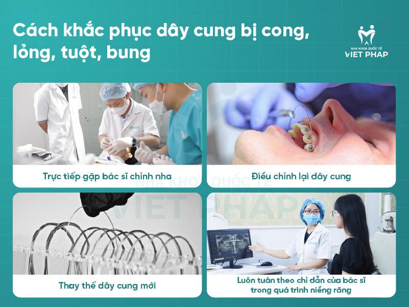 Day cung nieng rang bi cong 5 Cách khắc phục dây cung bị cong, lỏng, tuột, bung