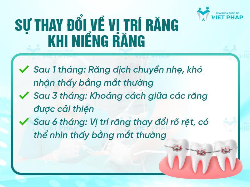 Sự thay đổi về vị trí răng khi niềng răng