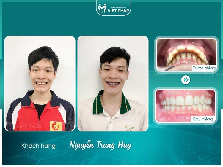 Khách hàng Nguyễn Trung Huy