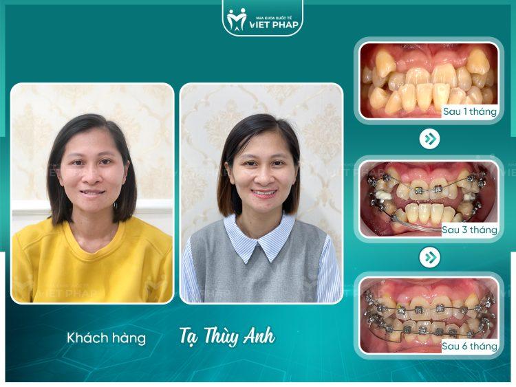Khách hàng Tạ Thùy Anh