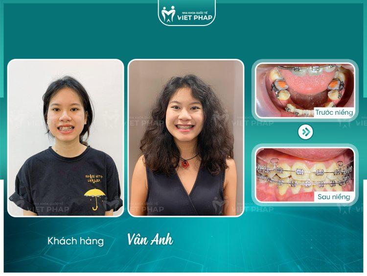 Khách hàng Vân Anh
