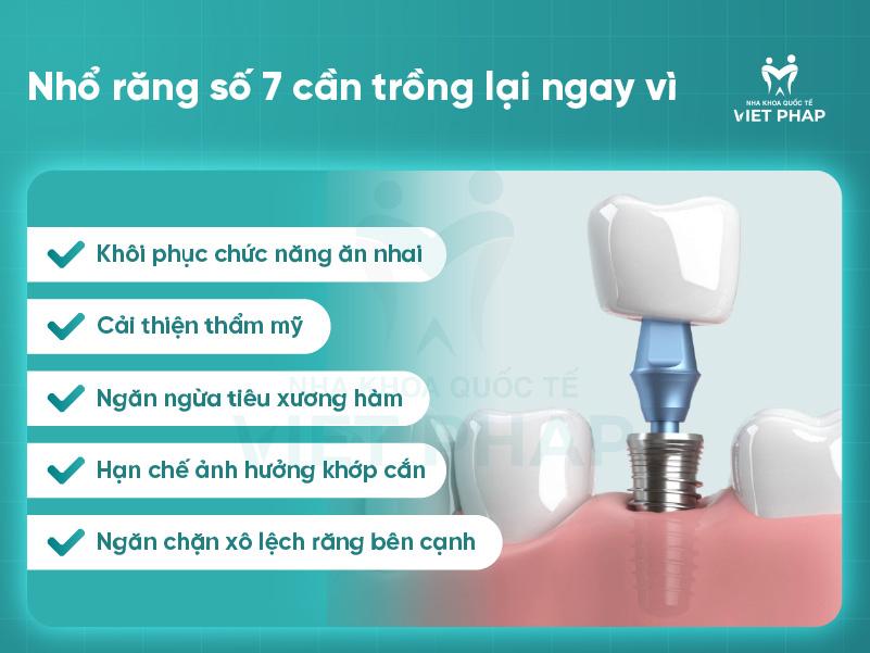 Nhổ răng số 7 cần trồng lại ngay vì 