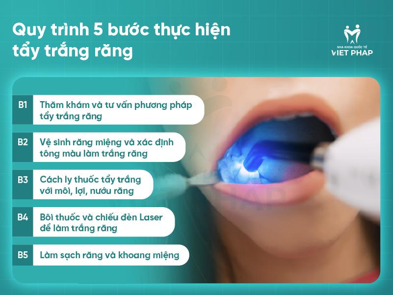 Quy trình 5 bước thực hiện tẩy trắng răng 