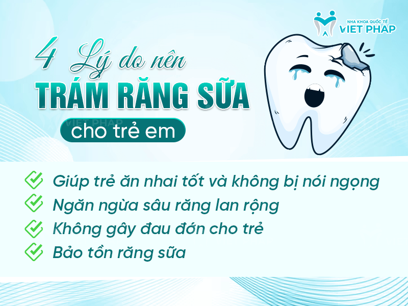 4 lý do nên trám răng sữa cho trẻ em