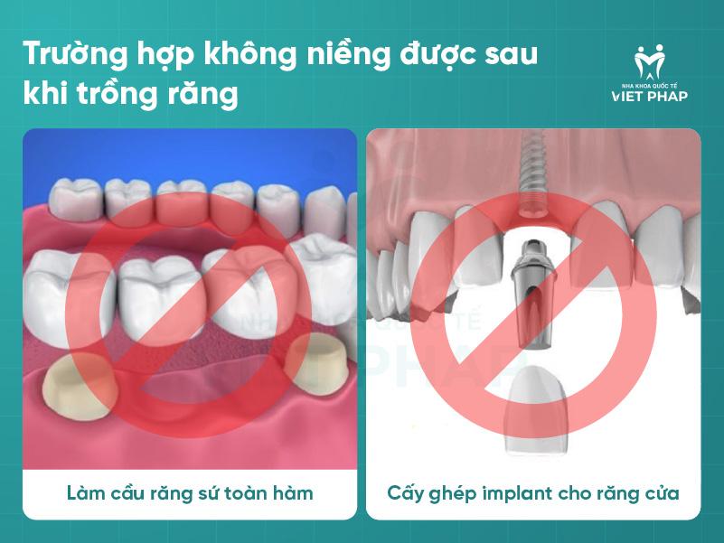 Trong rang co nieng duoc khong Nha khoa Quoc Te Viet Phap 1 Trường hợp không niềng được sau khi trồng răng
