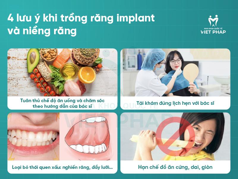 Trong rang co nieng duoc khong Nha khoa Quoc Te Viet Phap 5 4 lưu ý khi trồng răng implant và niềng răng