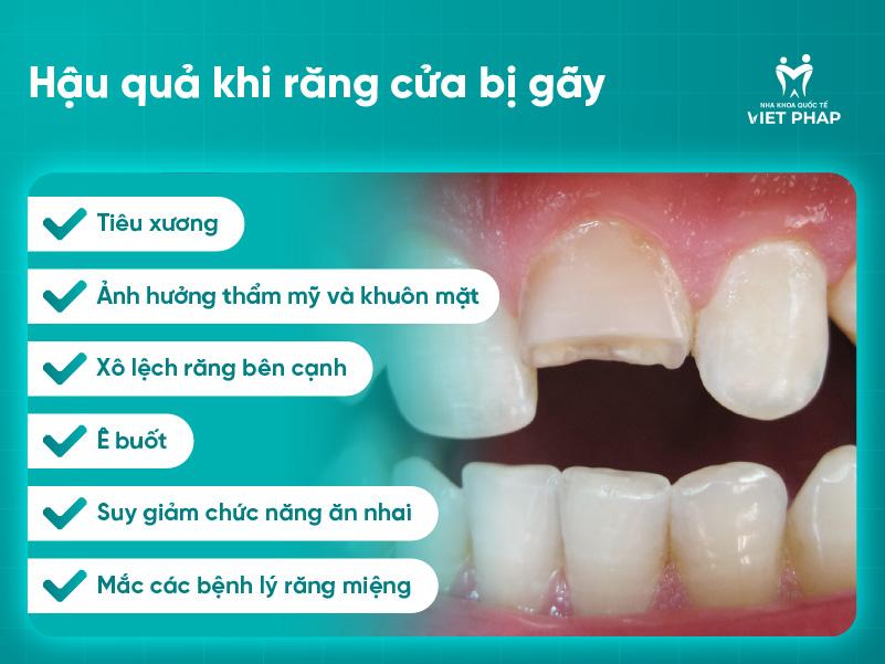 Hậu quả khi răng cửa bị gãy
