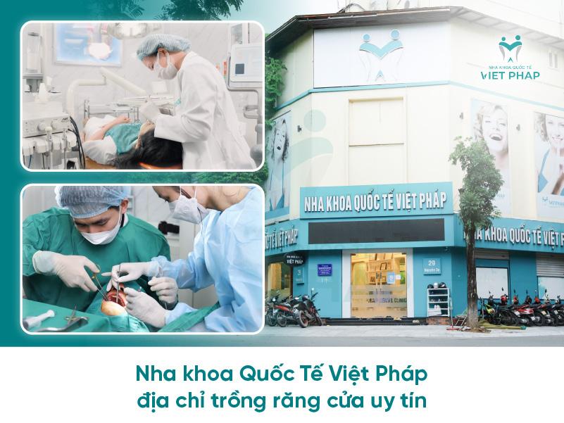 Nha khoa Quốc Tế Việt Pháp địa chỉ trồng răng cửa uy tín