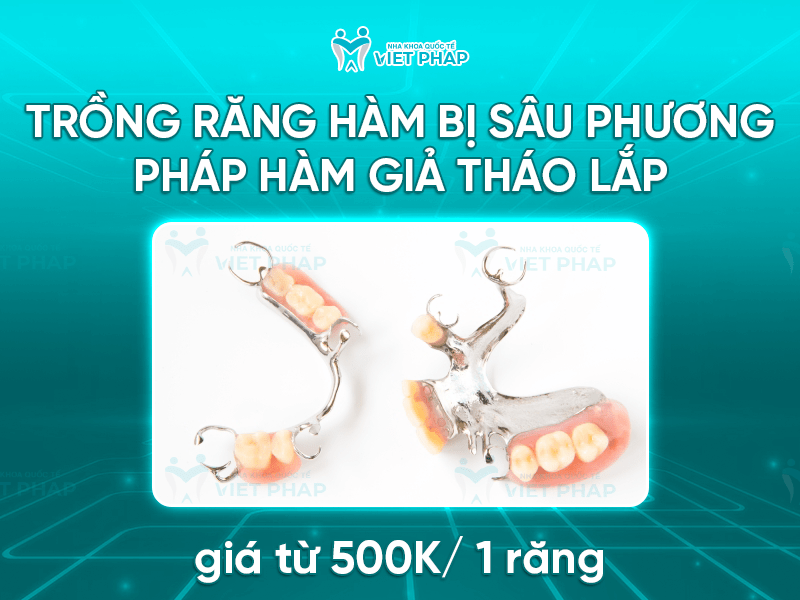 Trong rang ham bi sau gia bao nhieu 4 Trồng răng hàm bị sâu bằng phương pháp hàm giả tháo lắp giá chỉ từ 500.000 VNĐ trở lên