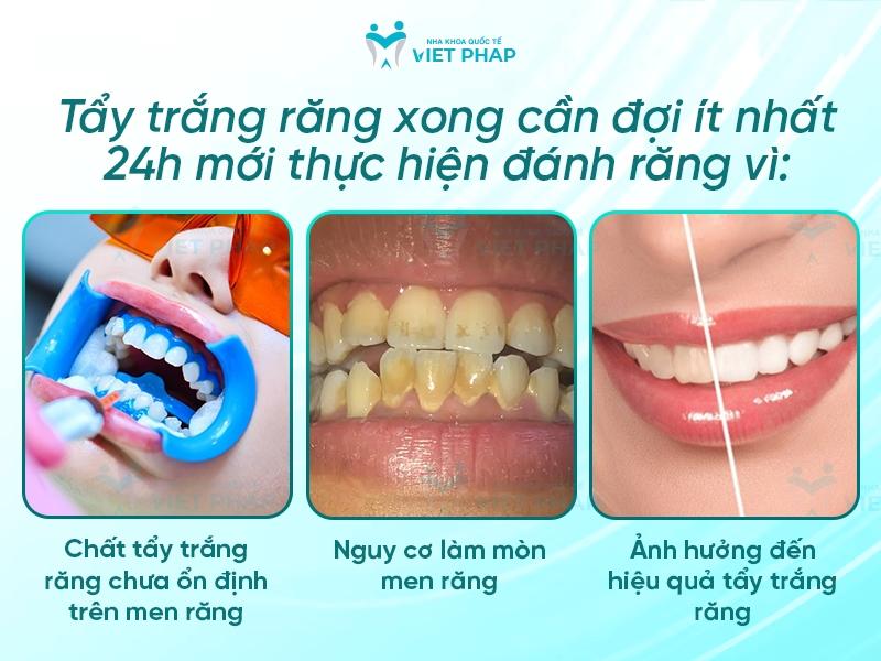 Tẩy trắng răng xong cần đợi ít nhất 24 giờ mới thực hiện đánh răng
