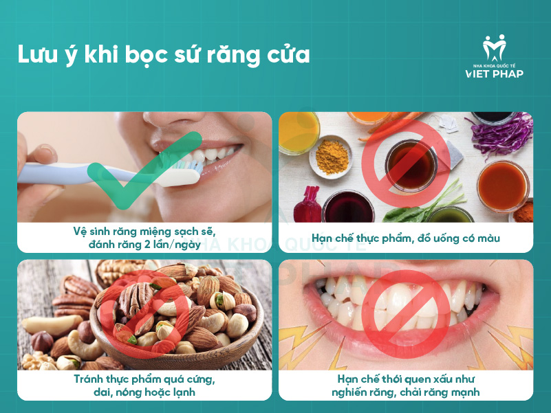 boc su rang cua 7 Lưu ý khi bọc sứ răng cửa