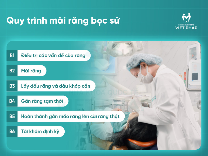 mai rang su 4 Quy trình mài răng bọc sứ