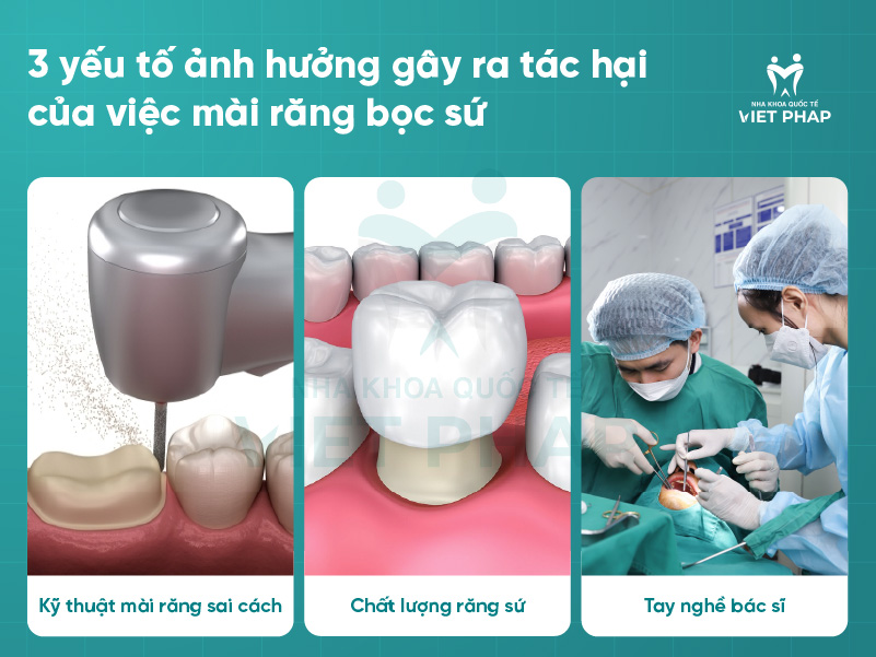 tac hai mai rang boc 6 Các yếu tố ảnh hưởng gây tác hại của việc mài răng bọc sứ