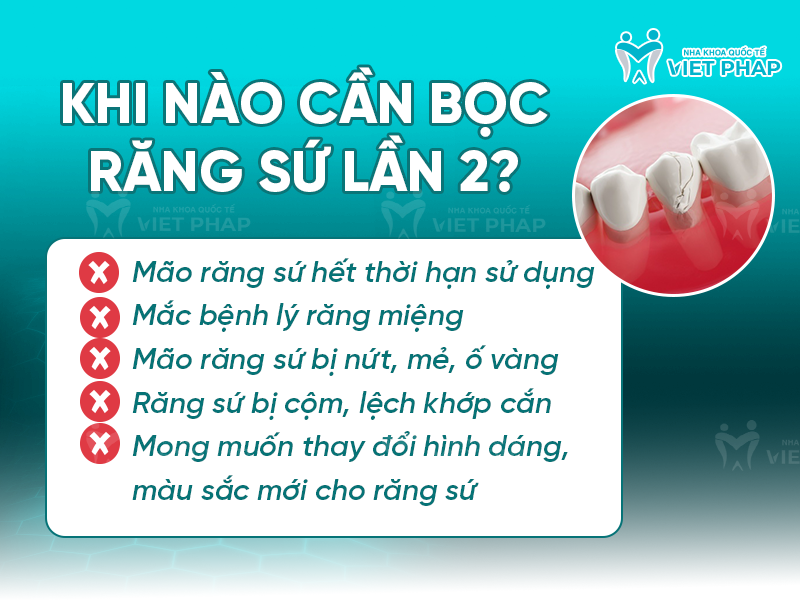 boc rang su lan 2 2 Khi nào cần bọc răng sứ lần 2?