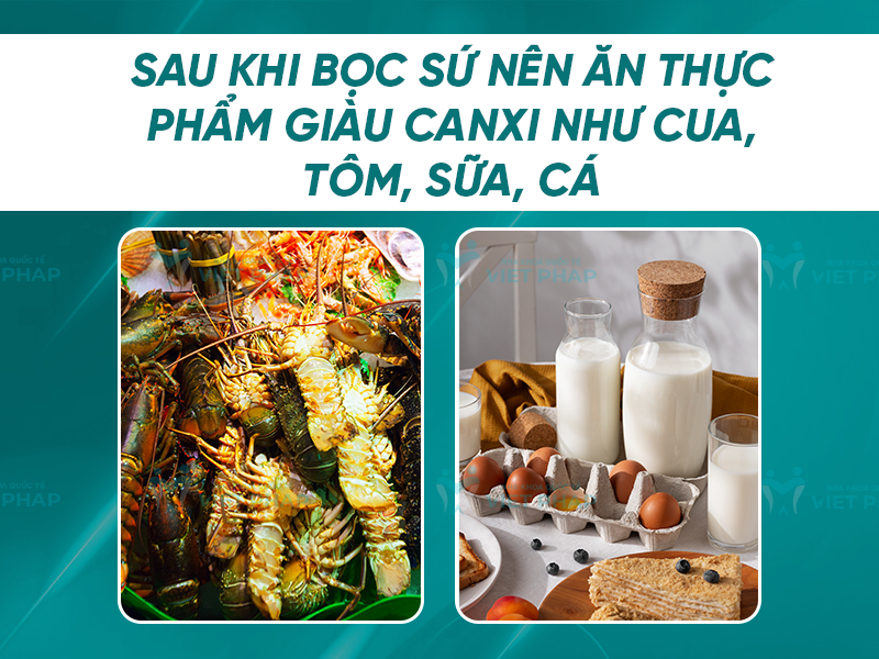 boc rang su nen kieng gi 5 Sau khi bọc sứ nên ăn thực phẩm giàu canxi như cua, tôm, sữa, cá...