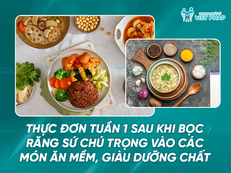 boc rang su nen kieng gi 7 Thực đơn tuần 1 sau khi bọc sứ chú trọng vào các món ăn mềm, giàu dưỡng chất