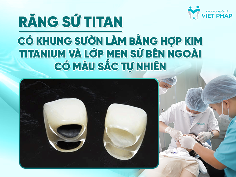Răng sứ titan có khung sườn làm bằng hợp kim titanium và lớp sứ bên ngoài