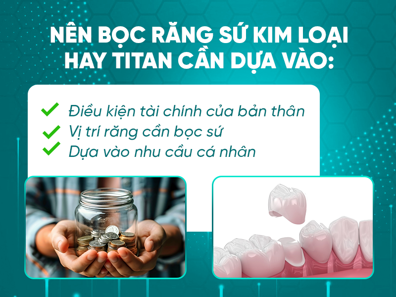 3 tiêu chí giúp khách hàng lựa chọn nên bọc răng sứ kim loại hay titan
