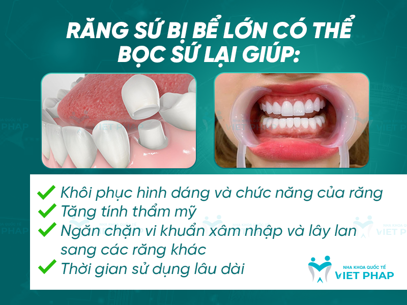 Răng sứ bị bể lớn có thể bọc sứ lại