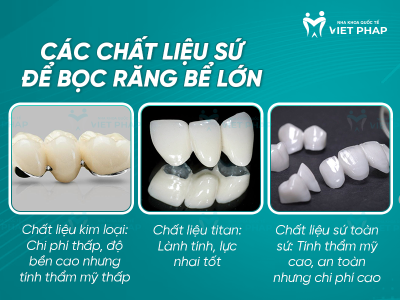 Các chất liệu sứ để bọc răng bể lớn