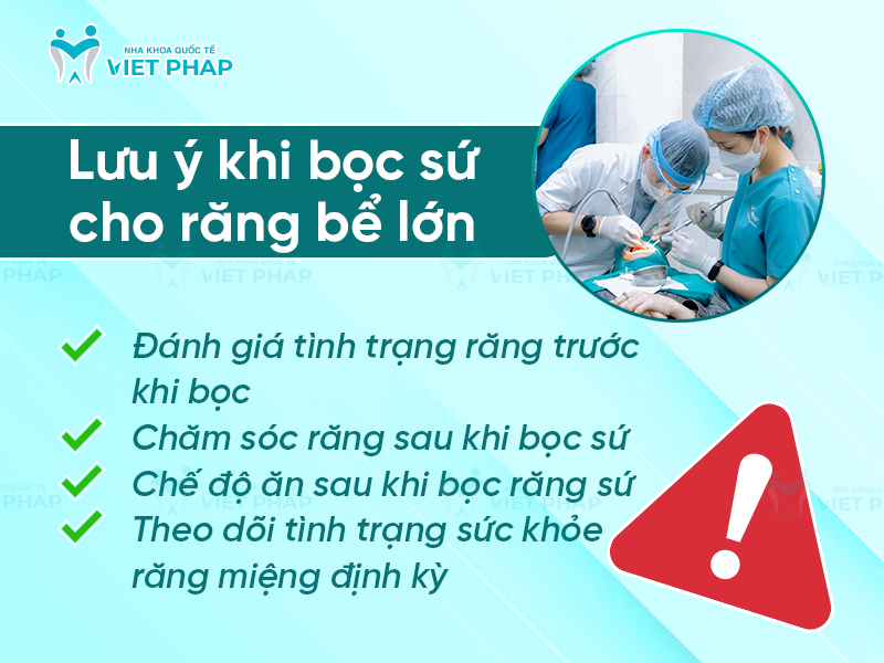 Lưu ý khi bọc sứ cho răng bể lớn