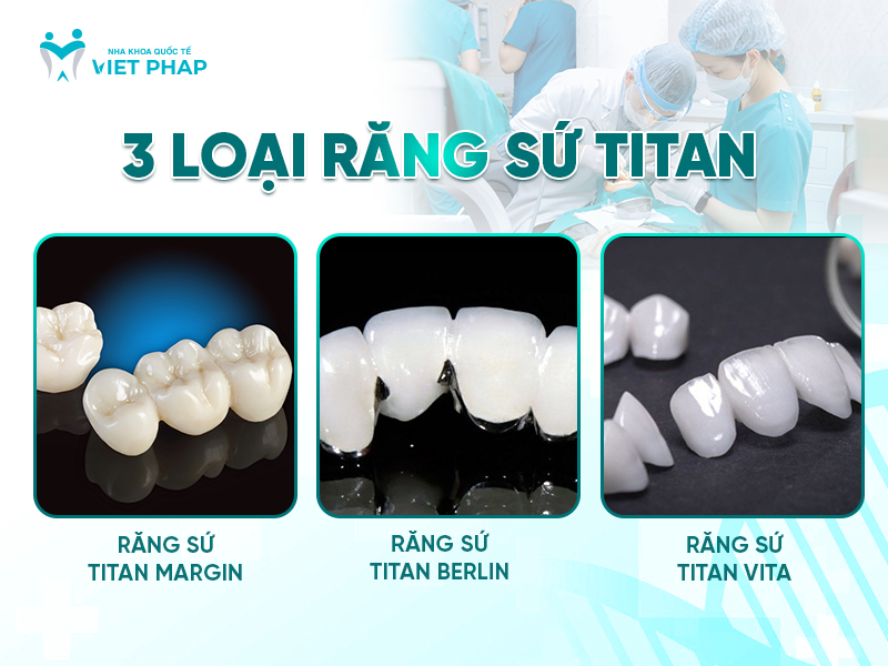 rang su titan co may loai 1 3 loại răng sứ titan phổ biến hiện nay
