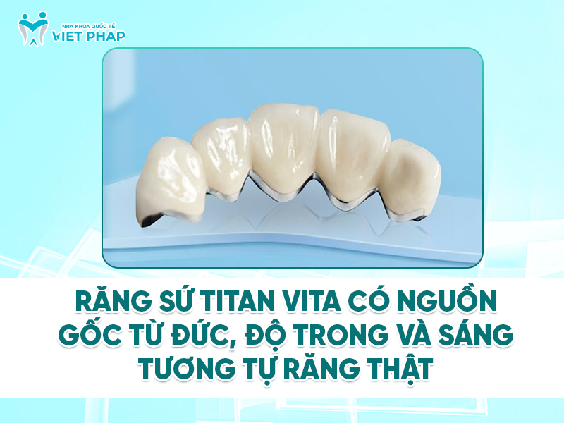 rang su titan co may loai 2 Răng sứ titan Vita có nguồn gốc từ Đức, độ trong và sang như răng thật